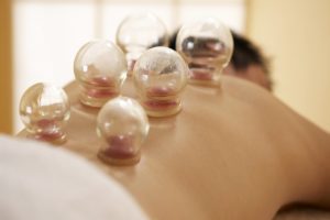 Hijama
